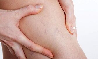 hanketan barizeak garatzeko arrazoiak